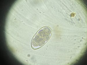 Trichostrongylus retortaeformis unterm Mikroskop