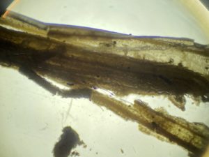 Schimmelpilze im Heu (unter dem Mikroskop)Stachybotris